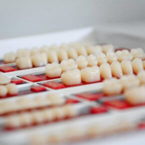 10 Fakten über die Zahnpflege in Ungarn
